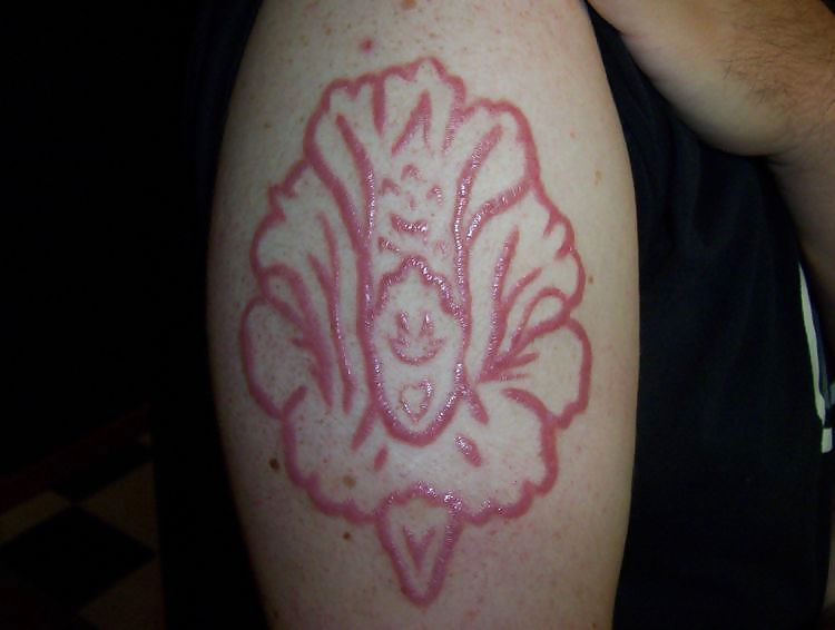 Scarification - teens most popular body modification #9454220