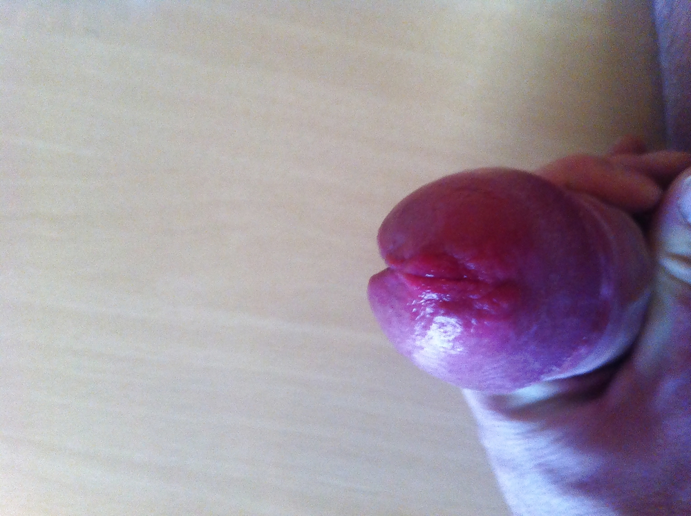 Meeee:))))
 #22350643