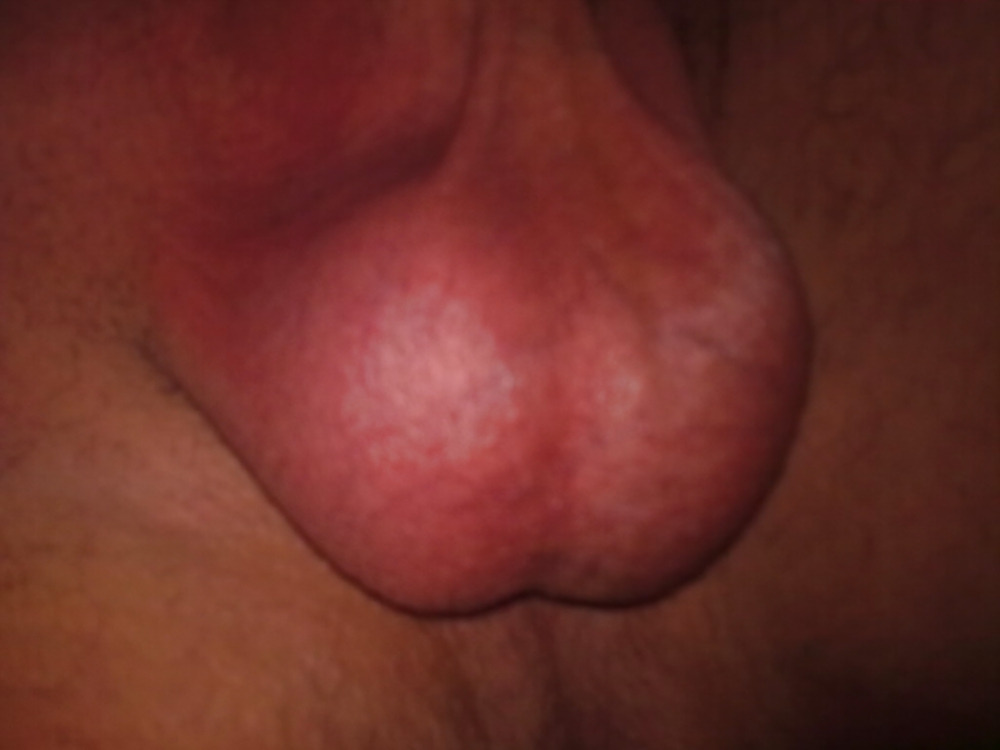 Of the testis #13838920