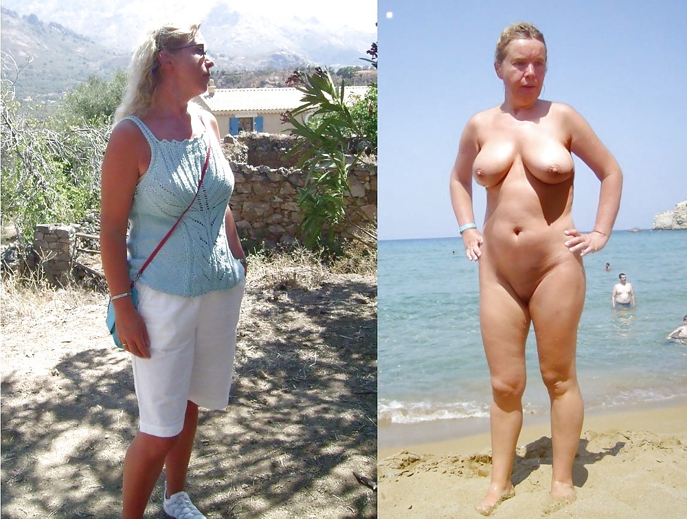 Before after 350. #3908160