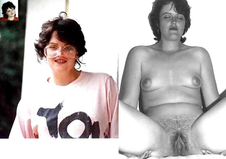 Before after 350. #3908181