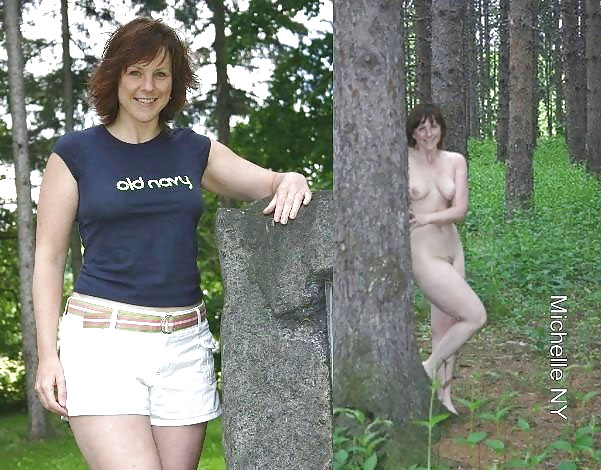 Before after 350. #3908270