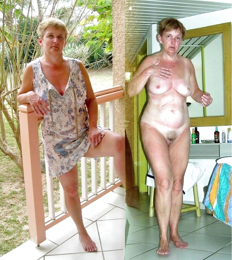 Before after 285 (Older women special). #3499204