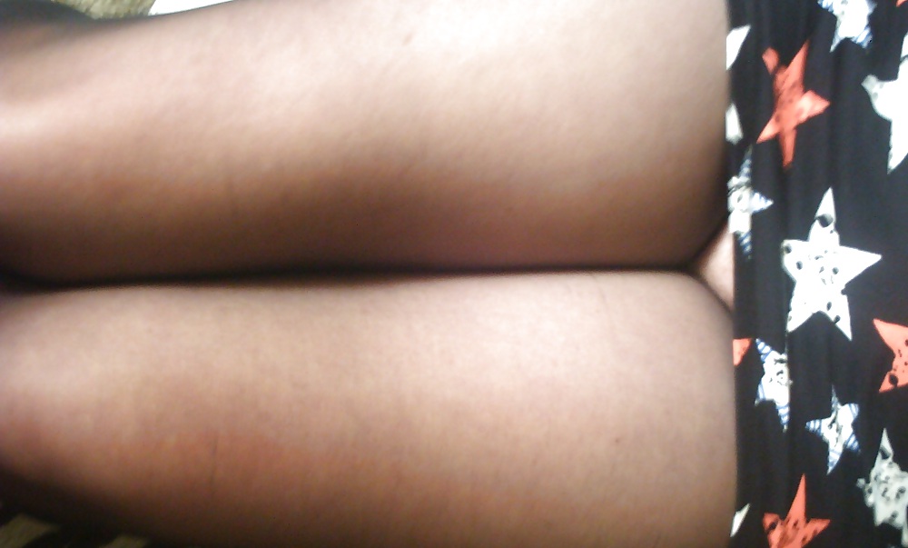 Fanny's summer season dilemma ! #9578246