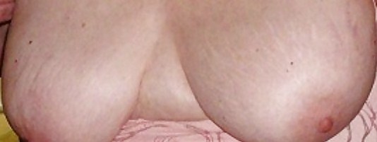 Necesita atención
 #10039315