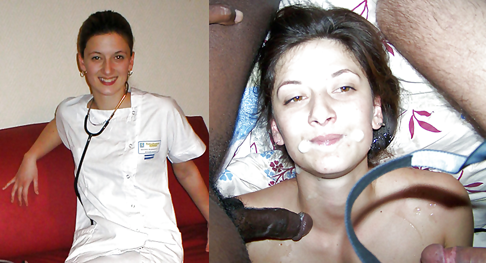 Before & After 3
 #10326945