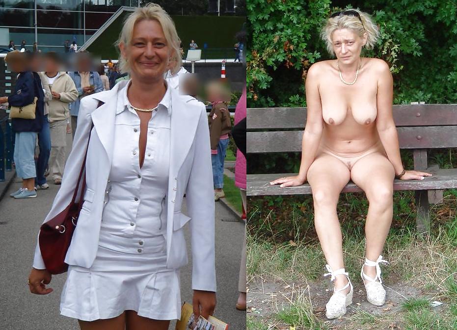 Before after 291. (Older women special). #3528901