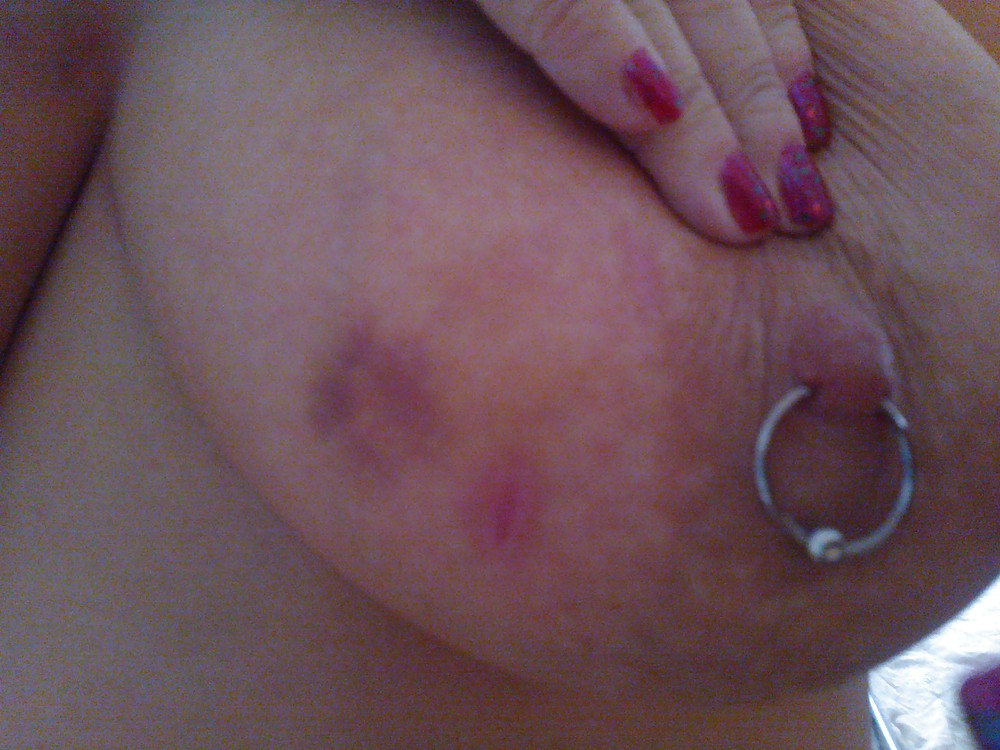 Scottish Slut - my newly pierced nipples #15303771