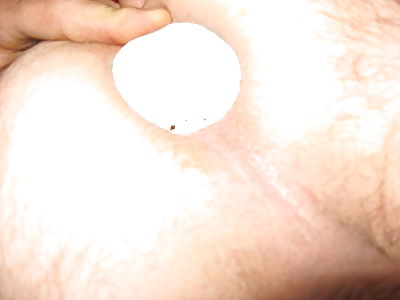 Dilatación
 #17139956