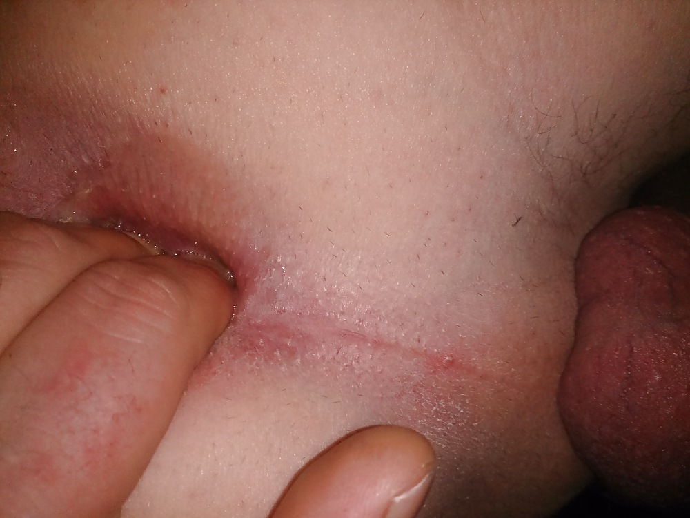 Plugged #22443610