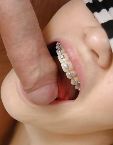 Cum on My Braces, Mister 2 #2201714