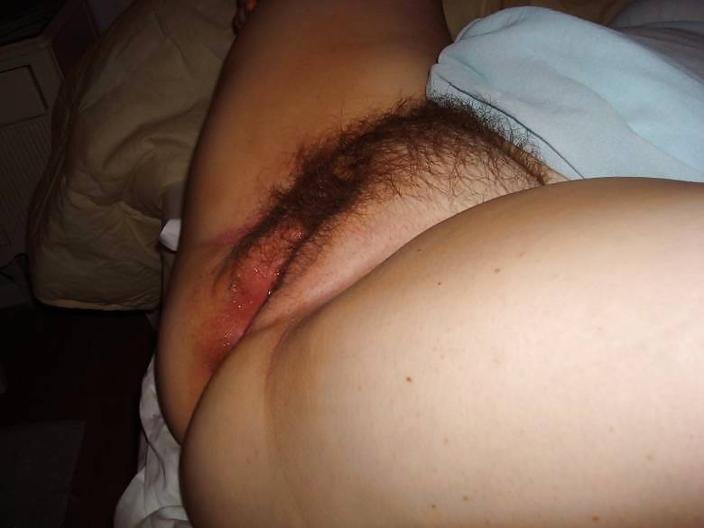 The Beauty of Hairy Hairy Amateurs #13155533