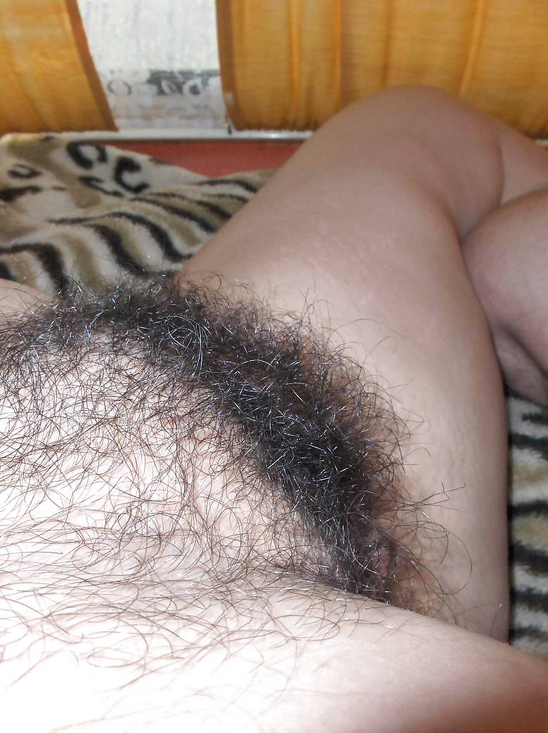 The Beauty of Hairy Hairy Amateurs #13155655