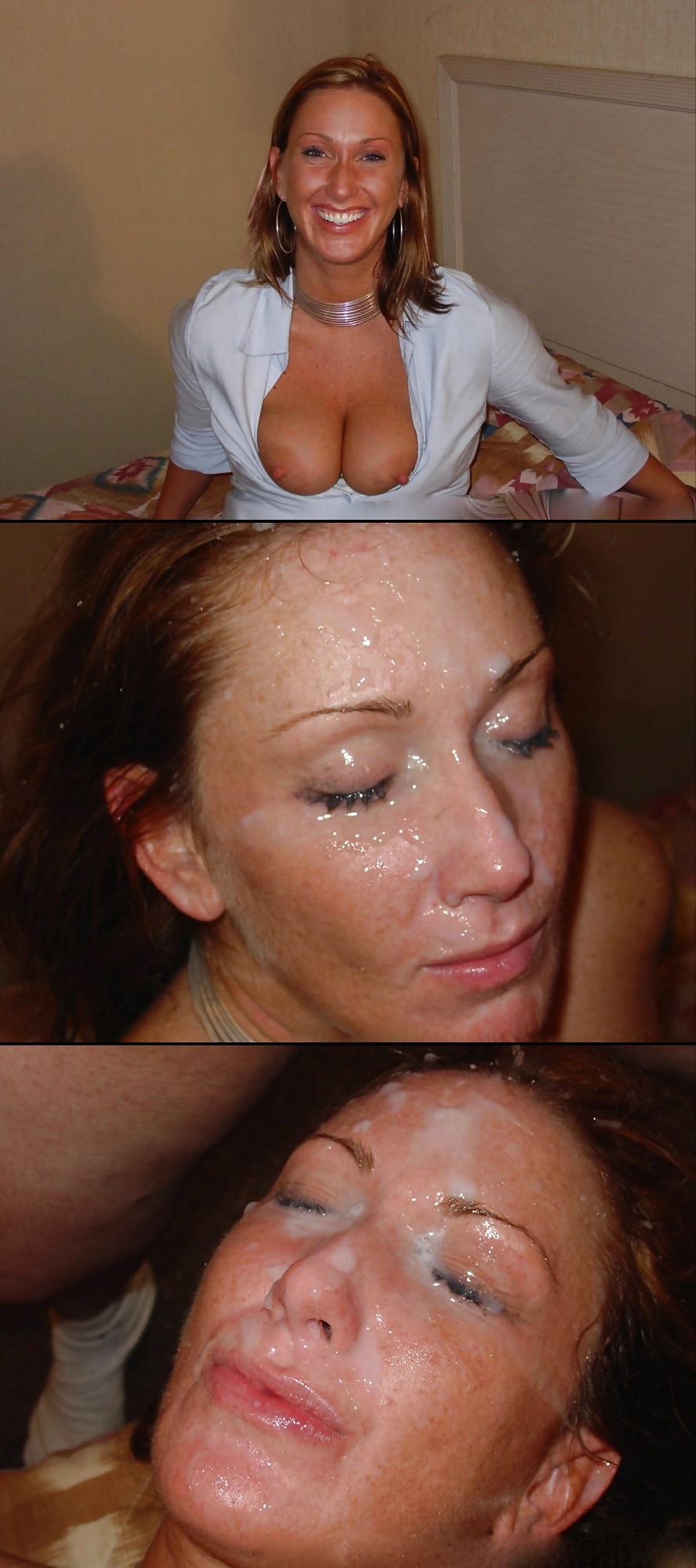 Before and After Facials 4 #11504825