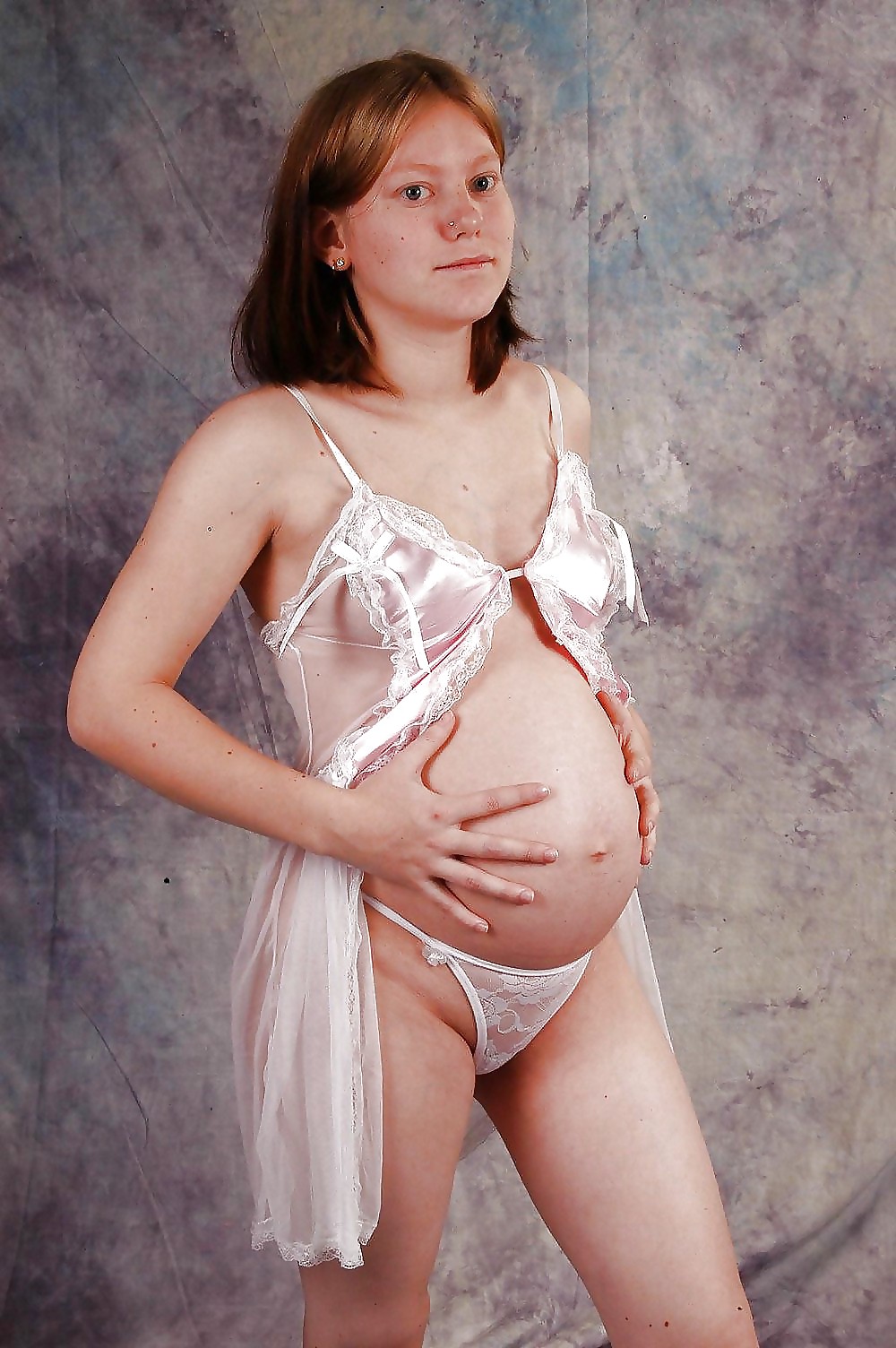 Preg #5090399