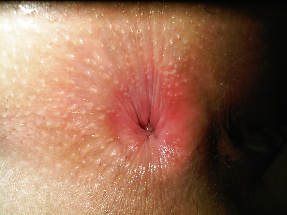 Poop Loops #17930603