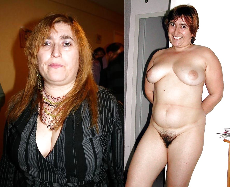 Before after 352. #4035079