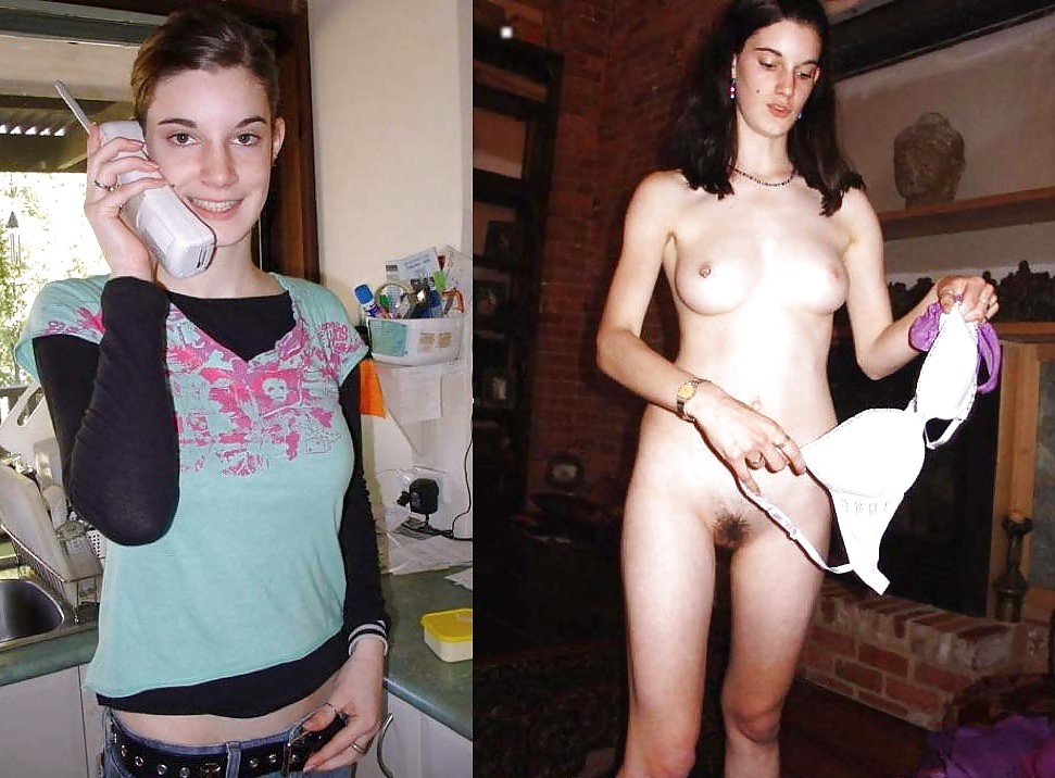 Before after 352. #4035184