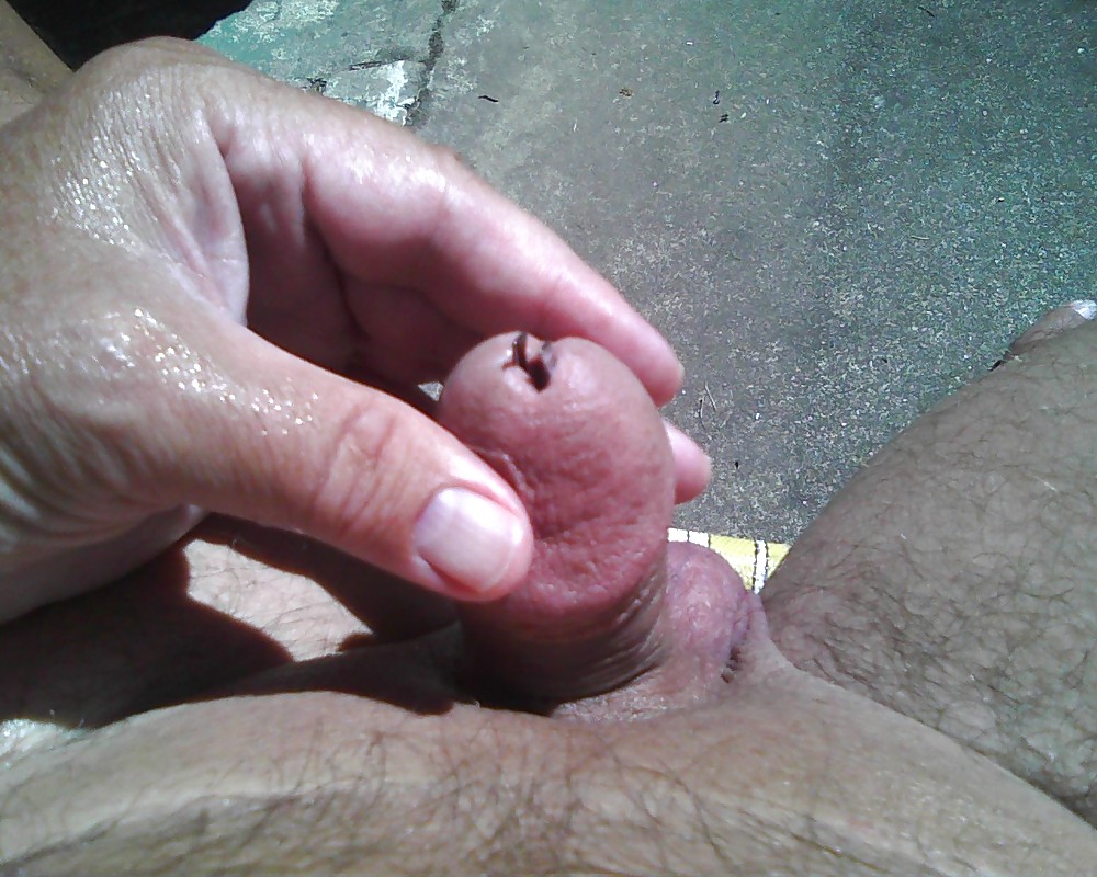 Peehole Stuffing with Tweezers on the Patio #21410434