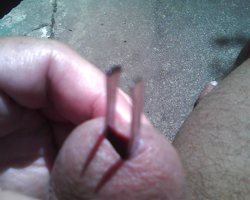 Peehole Stuffing with Tweezers on the Patio #21410448