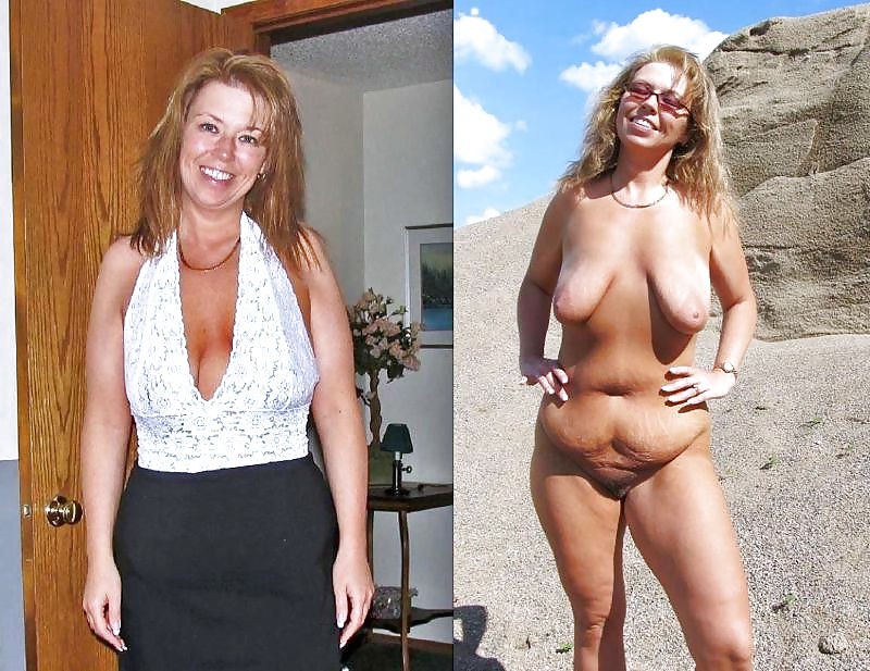 Before after 332 (older women special). #4805885