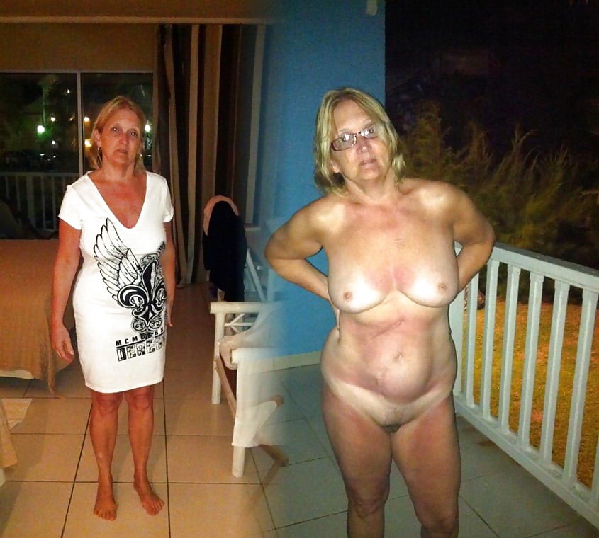 Before after 324 (Older women special). #3625209