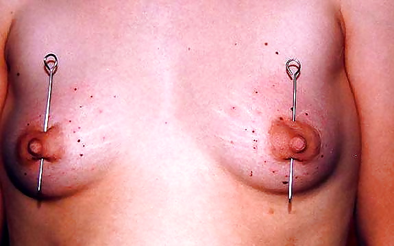 Schlüssel - Akupunkturpunkte Brust Springen Lassen #8347523