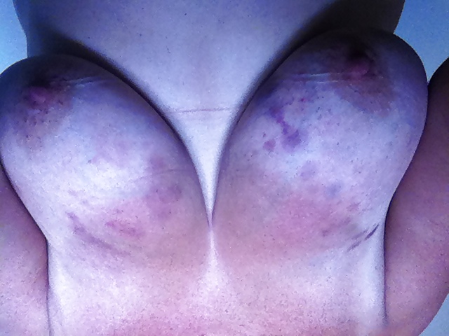 Tit Verwendung Oder? #20860955