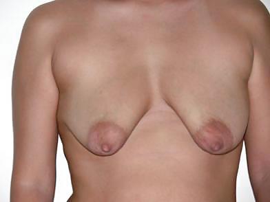 Puny empty saggy breasts 5