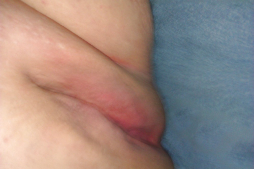 Moi 2 #16769329
