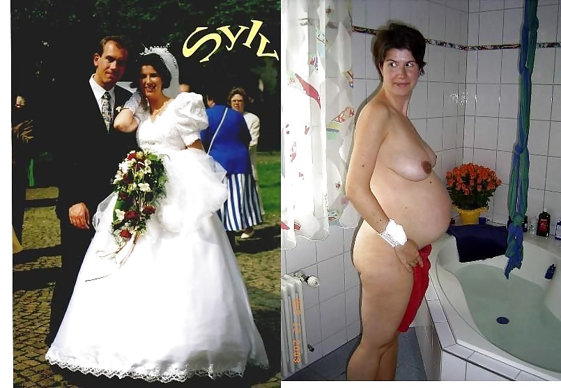 Before after 334. (Brides special) #3672785