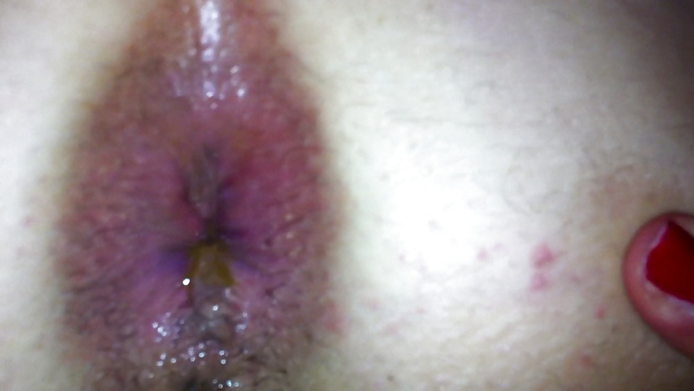 Gape Anal #21788955