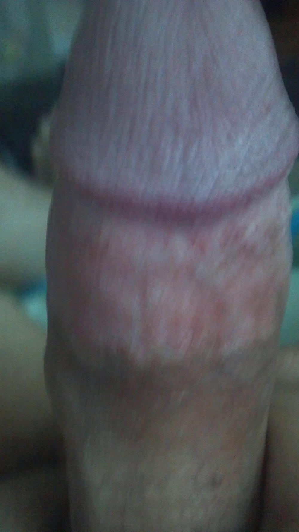 Muti cummer 