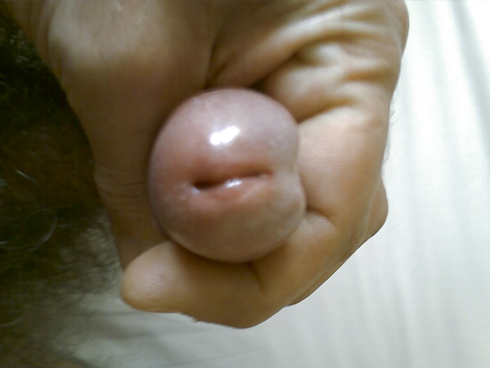 MEE #283336