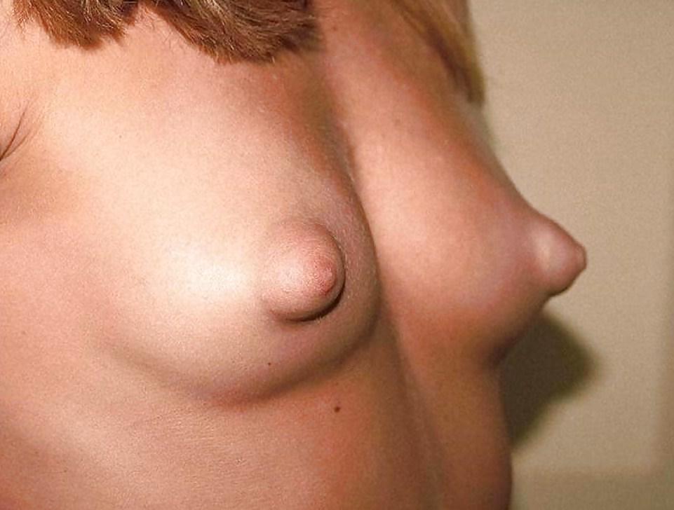 Puffy nipples 08 #3258772