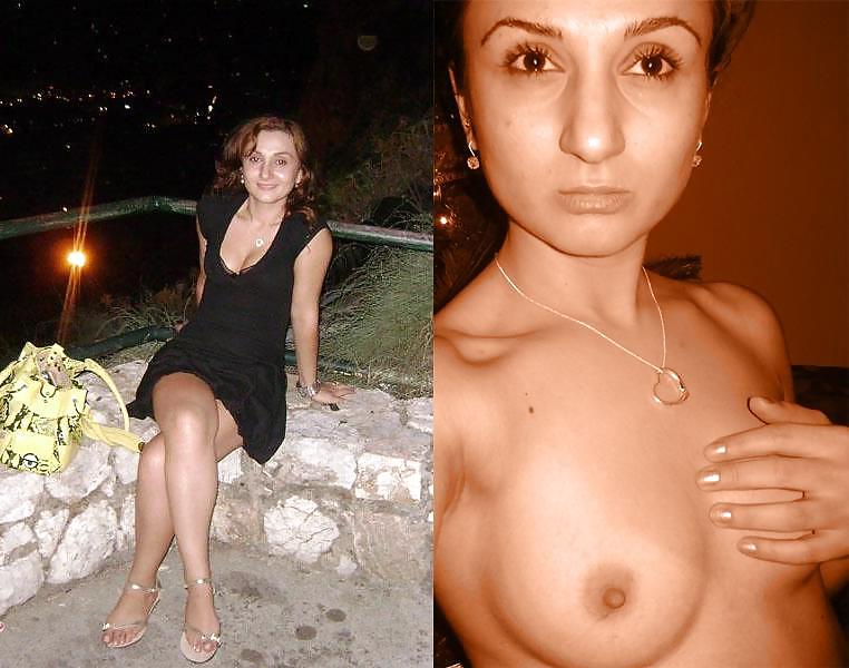Teens Before and After dressed undressed #13370046
