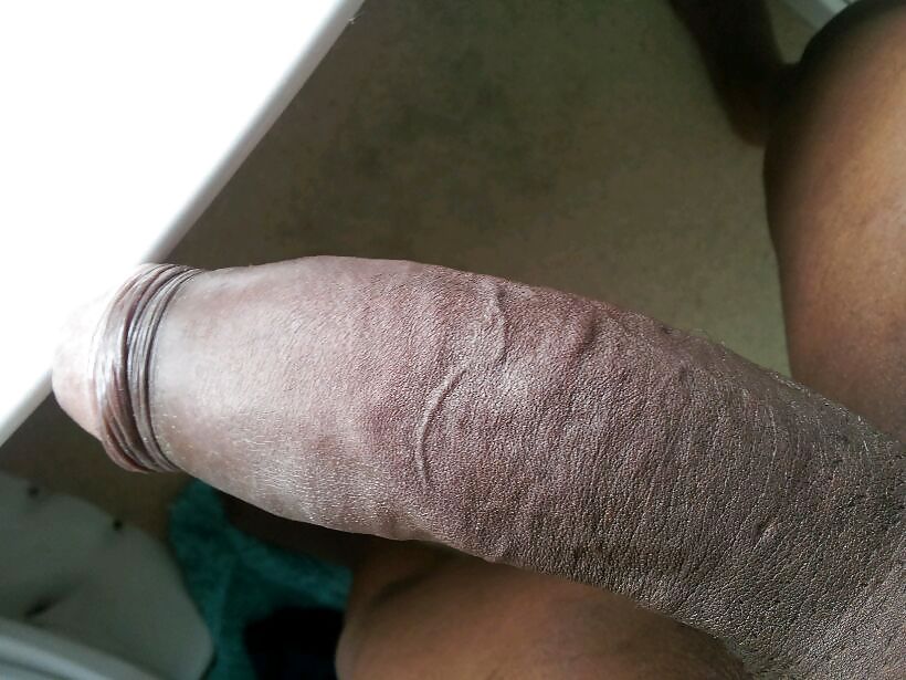 Glorious days #18919585