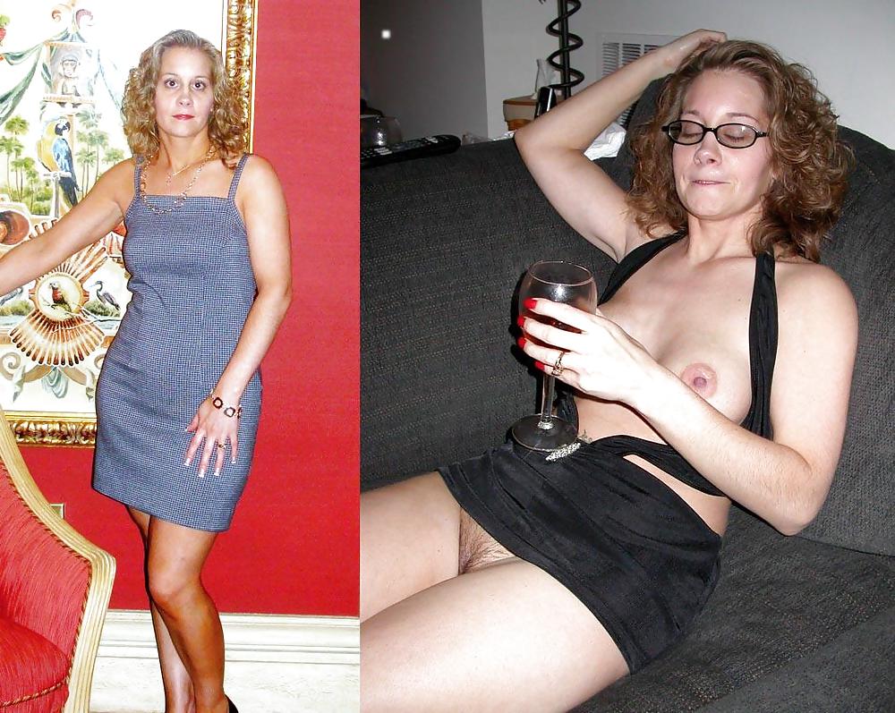 Before after 237. #4423527