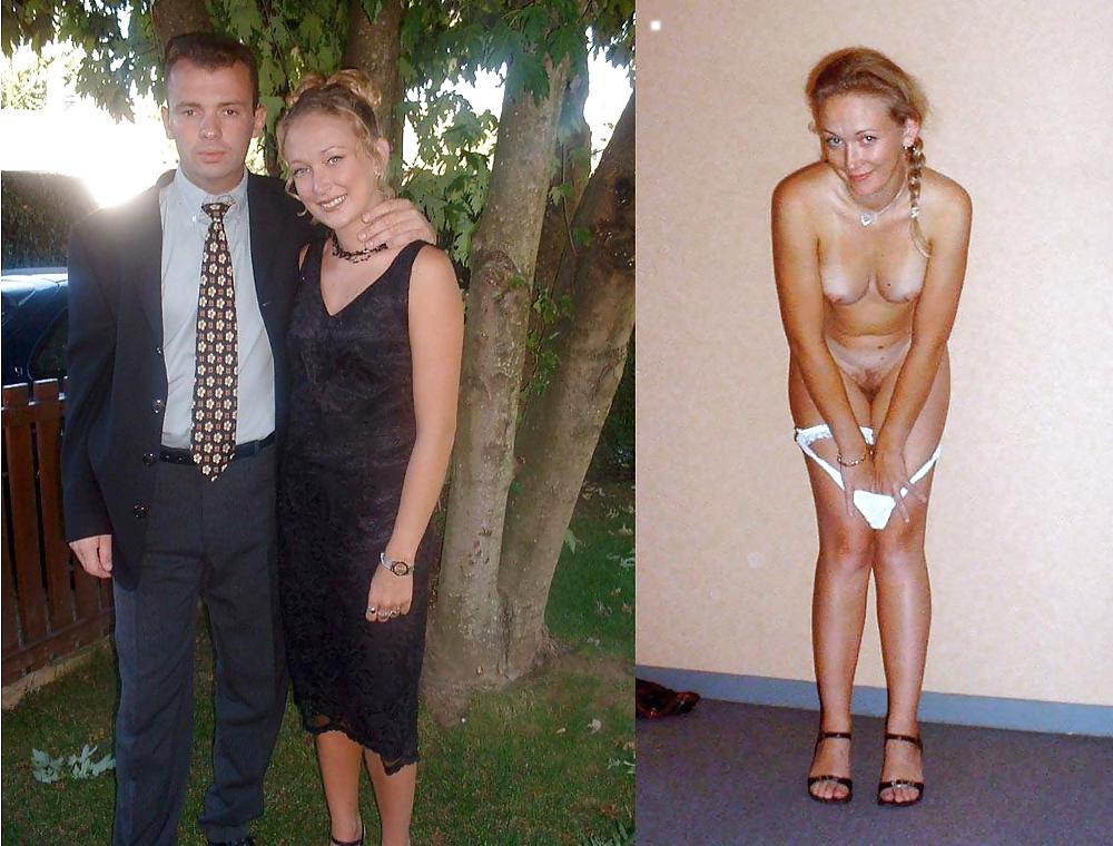 Before after 237. #4423546