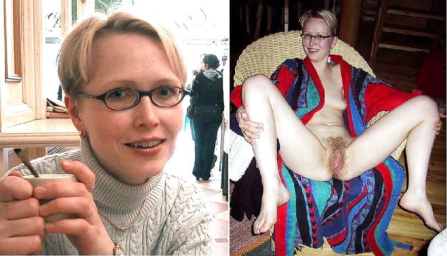 Before after 237. #4423569
