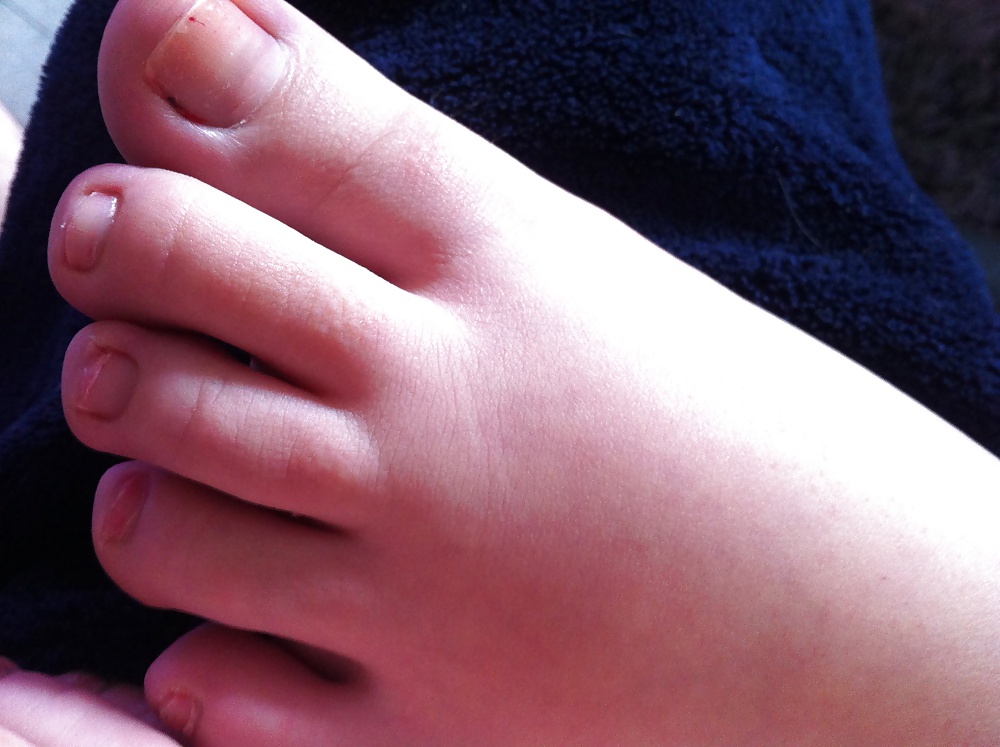 Who want to suck my toes? #16636218