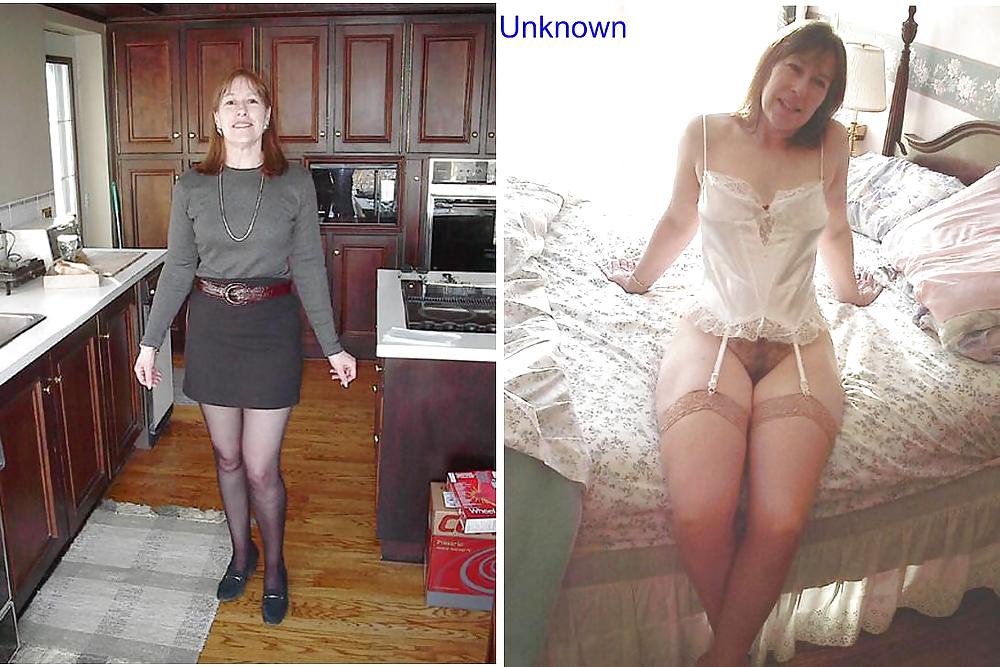 Before after 293. (Older women special). #4502732
