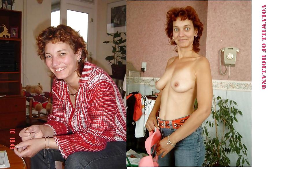 Before after 293. (Older women special). #4502744