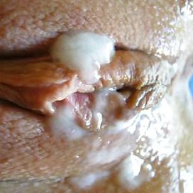 Anspritzen #11360890