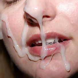 Anspritzen #11360963