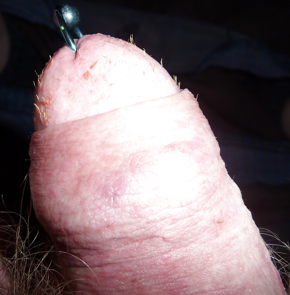 Pierced cock with hundreds of splinters in glans #1570538