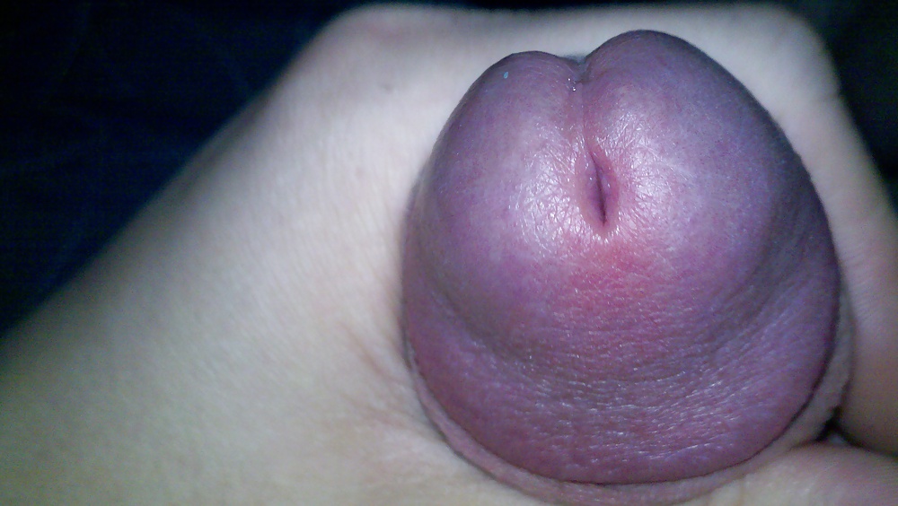 2011
 #7854176