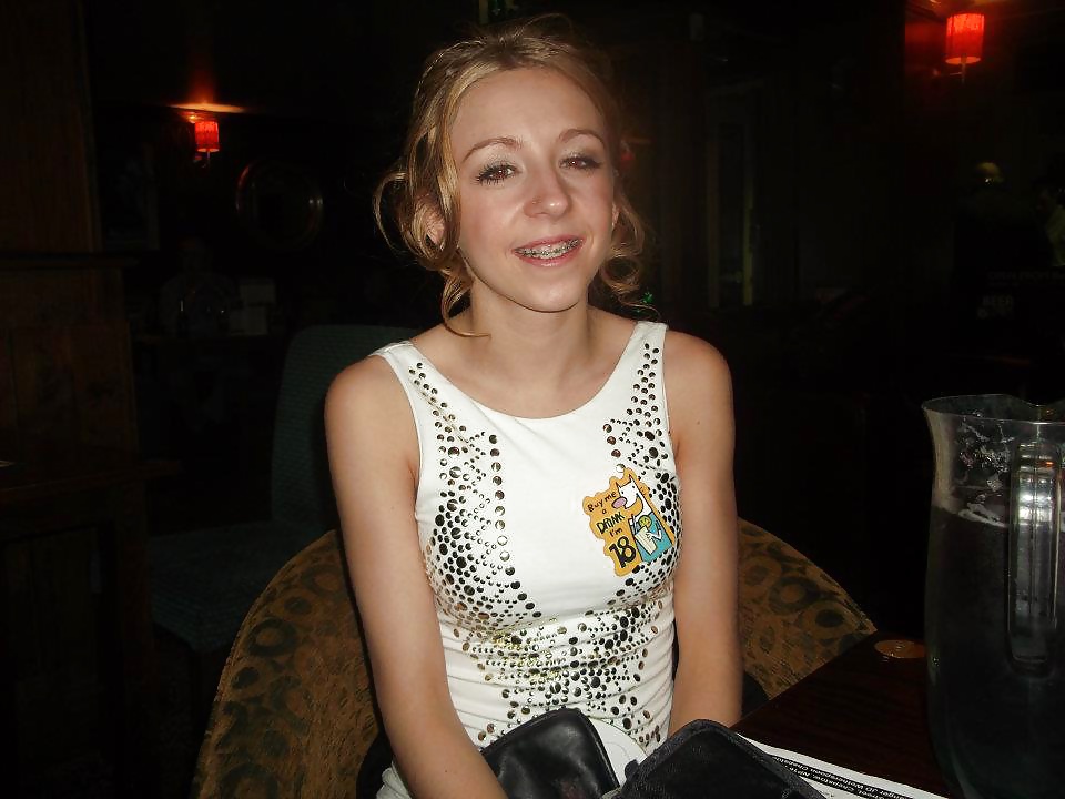 Me with my Braces :-(  #32448260