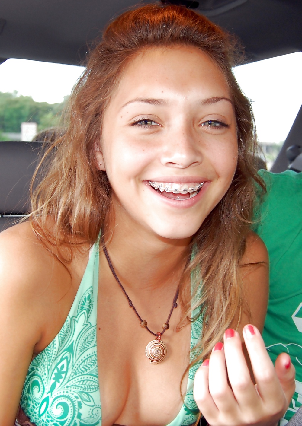 Teens With Braces 4 #29907611