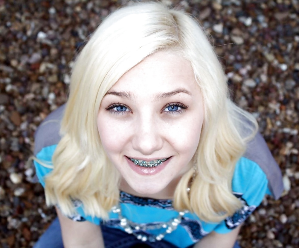 Teens With Braces 4 #29907616